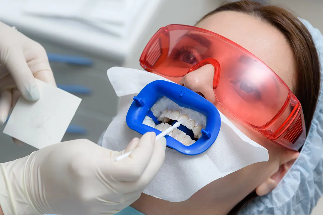 Patient wearing protective eyewear during an in-office teeth whitening treatment